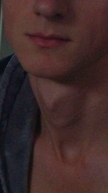Next Image >>