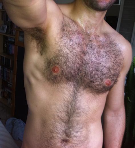 Next Image >>