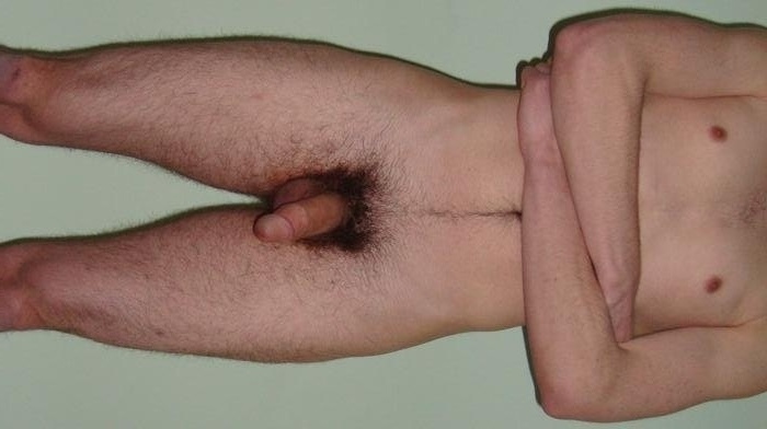 Next Image >>