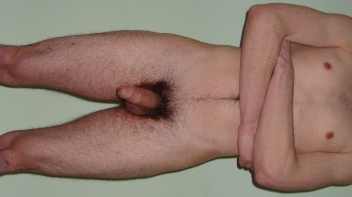 Next Image >>