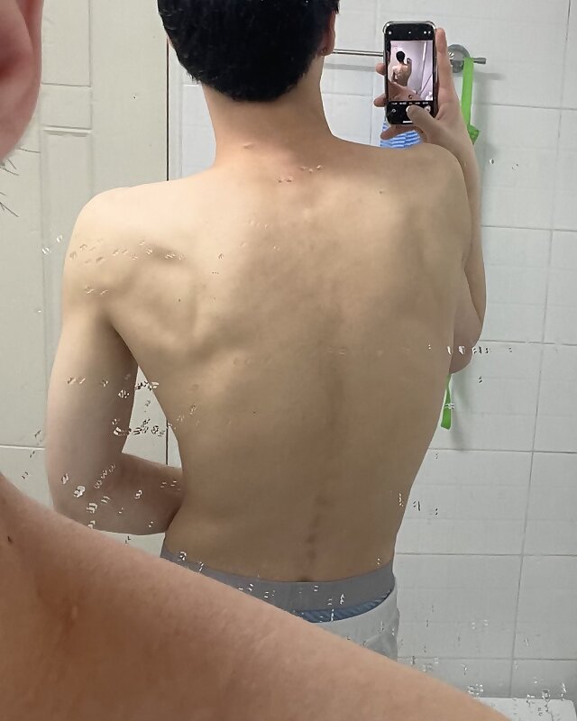Next Image >>
