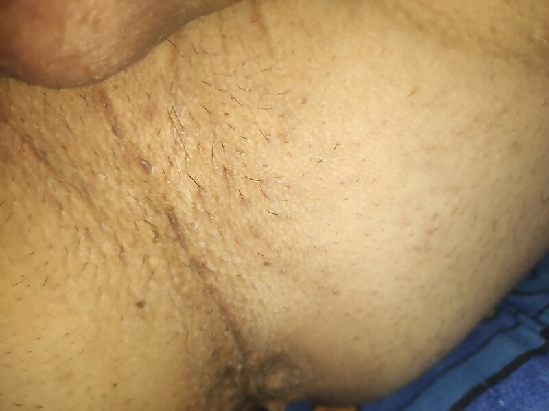Next Image >>