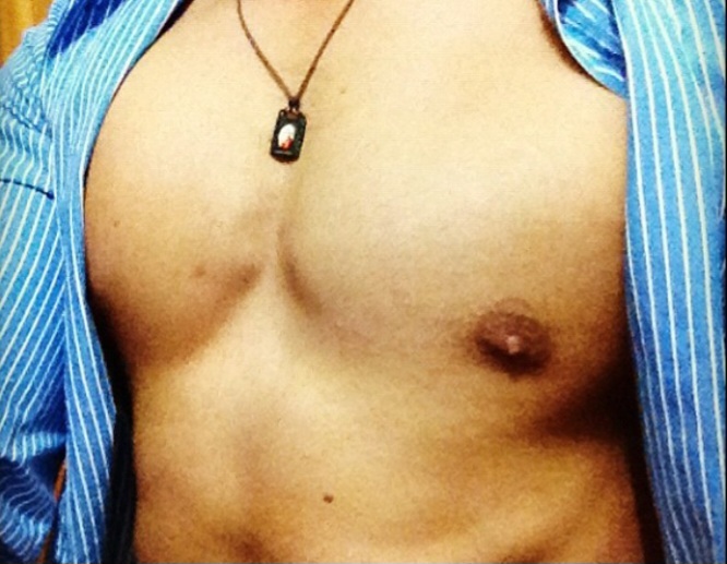 Next Image >>