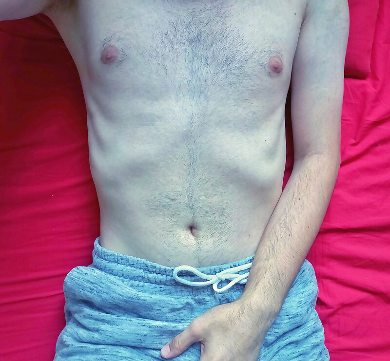 Next Image >>