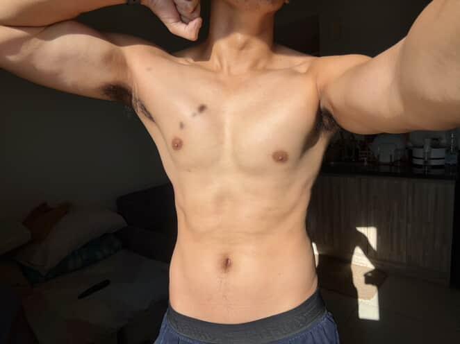 Next Image >>